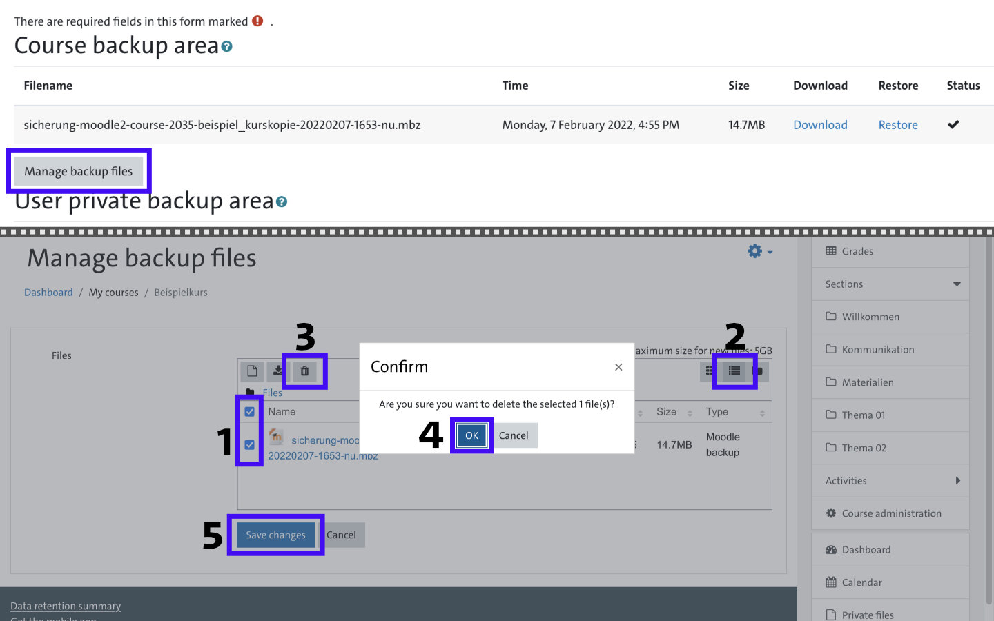 Screenshot: Manage backup files area